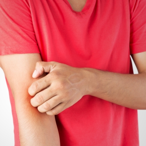 Allergy and Itch Relief